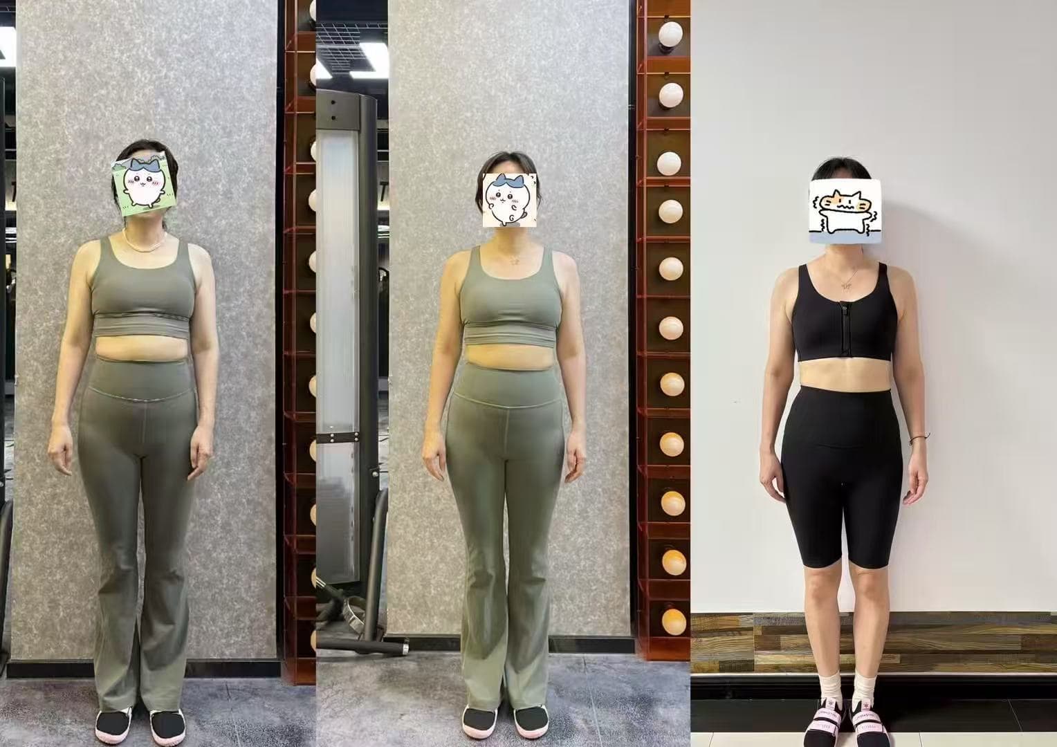 腰间盘突出学员一年力量训练后的正面阶段对比